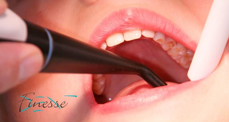 Finesse Dent - Clinica stomatologica sector 1
